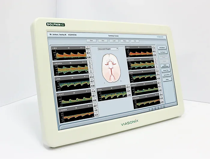 Dolphin 4D, sistema autônomo de doppler transcraniano com tela sensível ao toque